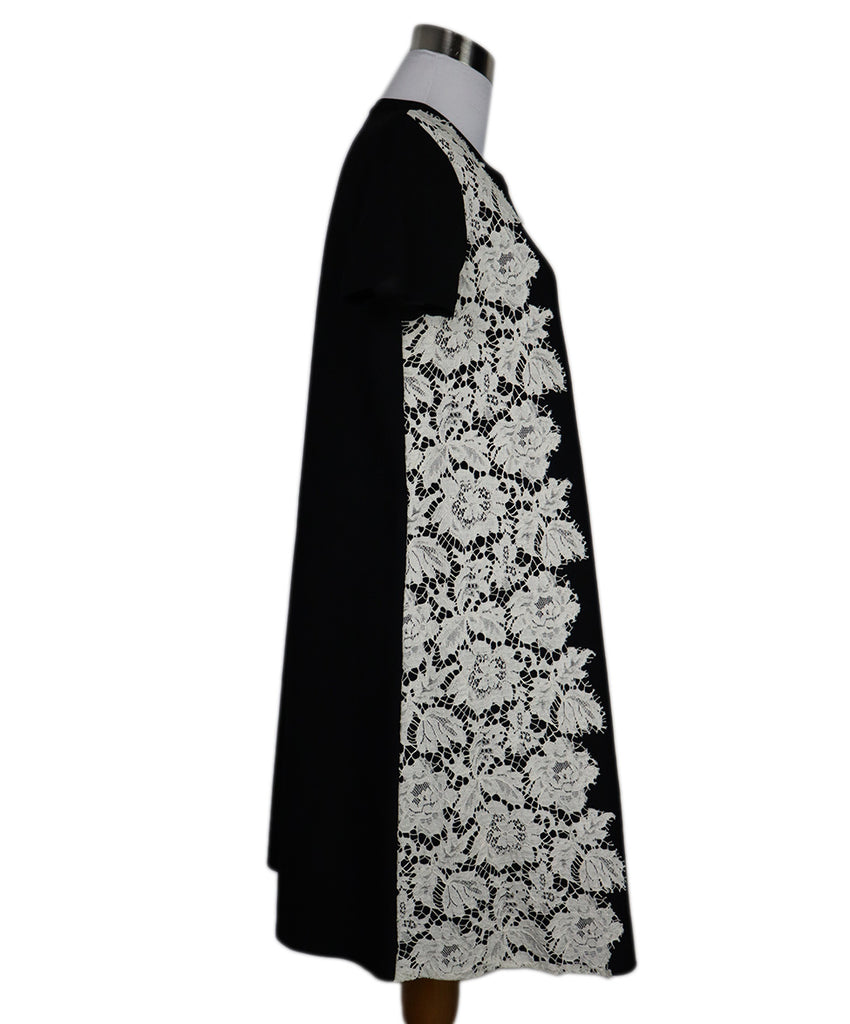 Valentino B&W Cotton Lace Dress 1